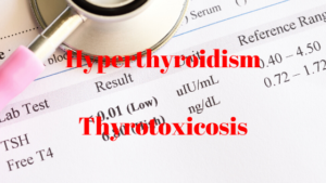 Hyperthyroidism