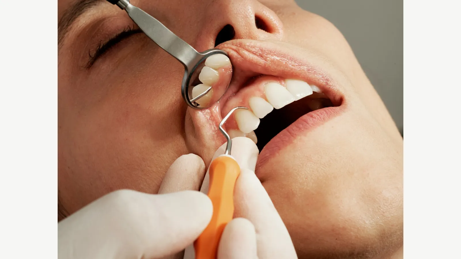 A dental professional examining teeth with a mirror and instrument.